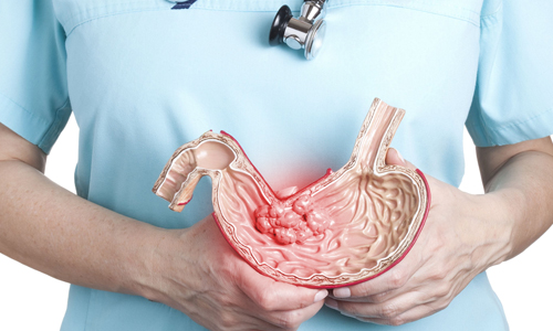 Cancer Surgery